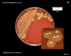 Staph on Schaedler (Schoedler) agar